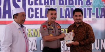 Meriahkan Hari Jadi ke-25, Polda Kalteng Gelar Operasi Bibir Sumbing