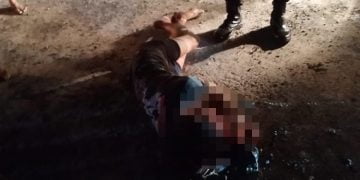 Dua Orang Terluka Parah Usai Baku Hantam di Depan Karaoke Nav